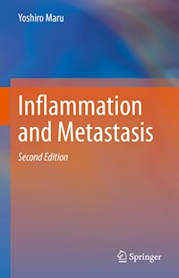 Inflammation and Metastasis - Yoshiro Maru - E-Book