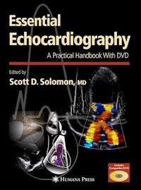 Essential Echocardiography -  - E-Book