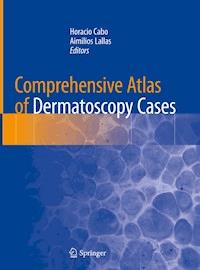 Comprehensive Atlas of Dermatoscopy Cases -  - E-Book
