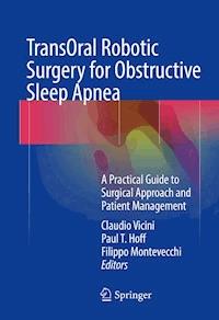 TransOral Robotic Surgery for Obstructive Sleep Apnea -  - E-Book