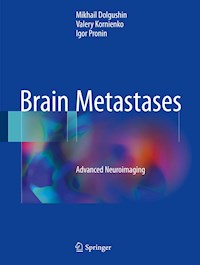 Brain Metastases - Mikhail Dolgushin - E-Book