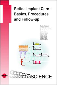 Retina Implant Care - Basics, Procedures and Follow-up - Peter Walter - E-Book