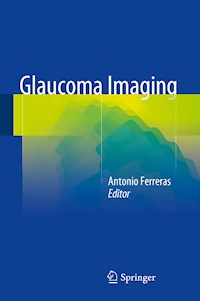 Glaucoma Imaging -  - E-Book