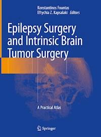 Epilepsy Surgery and Intrinsic Brain Tumor Surgery - - E-Book
