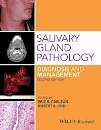 Salivary Gland Pathology - Eric R. Carlson - E-Book