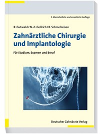 Zahnärztliche Chirurgie und Implantologie 3. A. - Ralf Gutwald - E-Book