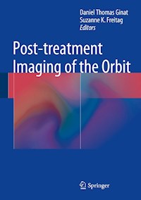 Post-treatment Imaging of the Orbit - - E-Book