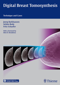 Digital Breast Tomosynthesis - Joerg Barkhausen - E-Book