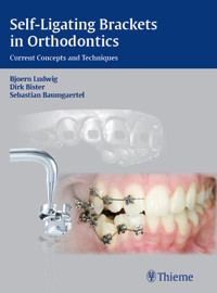Self-Ligating Brackets in Orthodontics - Dirk Bister - E-Book