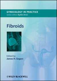 Fibroids -  - E-Book