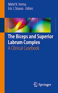 The Biceps and Superior Labrum Complex -  - E-Book