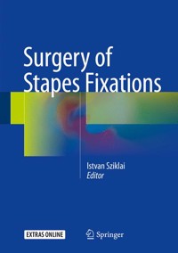 Surgery of Stapes Fixations -  - E-Book