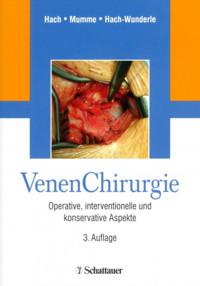 Venen Chirurgie -  - E-Book