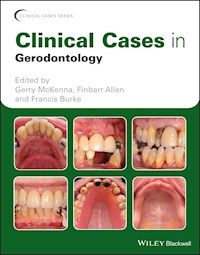 Clinical Cases in Gerodontology -  - E-Book