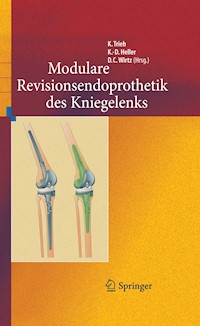 Revisionsendoprothetik des Kniegelenks - - E-Book