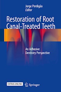 Restoration of Root Canal-Treated Teeth - - E-Book