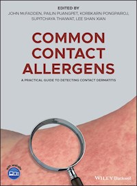 Common Contact Allergens -  - E-Book