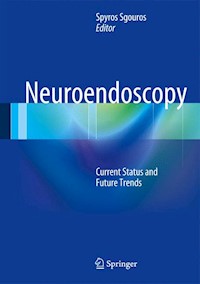 Neuroendoscopy -  - E-Book