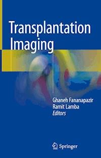 Transplantation Imaging -  - E-Book