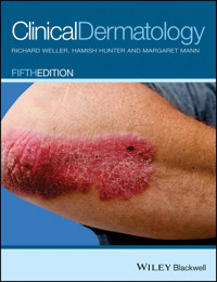 Clinical Dermatology - Richard B. Weller - E-Book