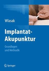 Implantat-Akupunktur - Rolf Wlasak - E-Book