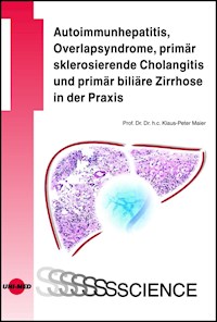 Autoimmunhepatitis, Overlapsyndrome, primär sklerosierende Cholangitis und primär biliäre Zirrhose in der Praxis - Klaus-Peter Maier - E-Book