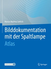 Bilddokumentation mit der Spaltlampe - Marcus-Matthias Gellrich - E-Book