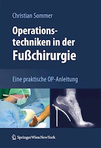 Operationstechniken in der Fußchirurgie - Christian Sommer - E-Book