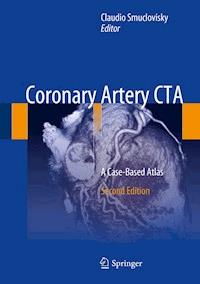Coronary Artery CTA -  - E-Book