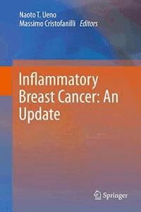 Inflammatory Breast Cancer: An Update - - E-Book