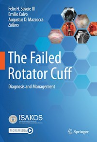 The Failed Rotator Cuff -  - E-Book