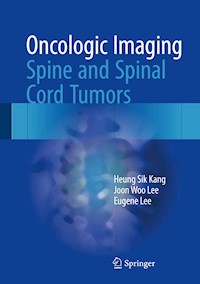 Oncologic Imaging: Spine and Spinal Cord Tumors - Heung Sik Kang - E-Book