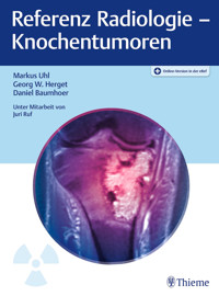 Referenz Radiologie - Knochentumoren - Markus Uhl - E-Book