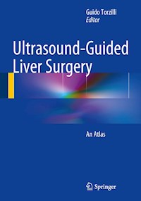 Ultrasound-Guided Liver Surgery -  - E-Book