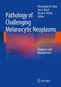 Pathology of Challenging Melanocytic Neoplasms - - E-Book