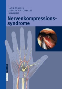 Nervenkompressionssyndrome -  - E-Book