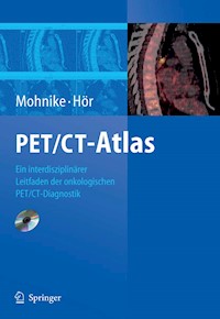 PET/CT-Atlas -  - E-Book