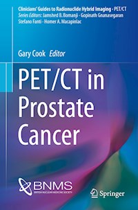 PET/CT in Prostate Cancer -  - E-Book
