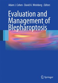 Evaluation and Management of Blepharoptosis - - E-Book
