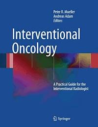 Interventional Oncology -  - E-Book
