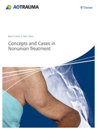 Concepts and Cases in Nonunion Treatment - Peter Kloen - E-Book