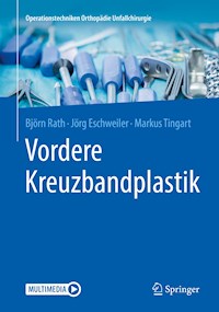 Vordere Kreuzbandplastik - Björn Rath - E-Book