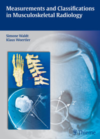 Measurements and Classifications in Musculoskeletal Radiology - Simone Waldt - E-Book