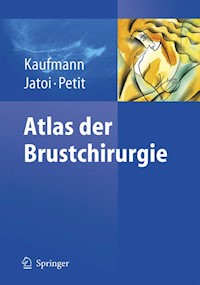 Atlas der Brustchirurgie -  - E-Book