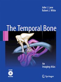Temporal Bone - John I. Lane - E-Book