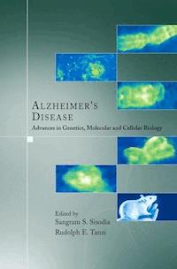 Alzheimer's Disease -  - E-Book