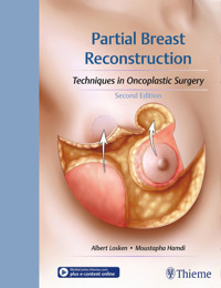 Partial Breast Reconstruction -  - E-Book