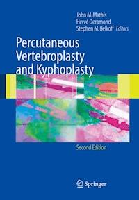 Percutaneous Vertebroplasty and Kyphoplasty -  - E-Book