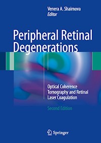 Peripheral Retinal Degenerations -  - E-Book
