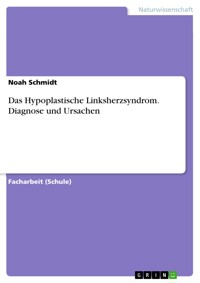 Das Hypoplastische Linksherzsyndrom. Diagnose und Ursachen - Noah Schmidt - E-Book